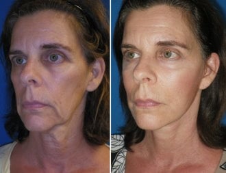 featured makeovers