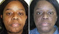 Charitable Surgeries