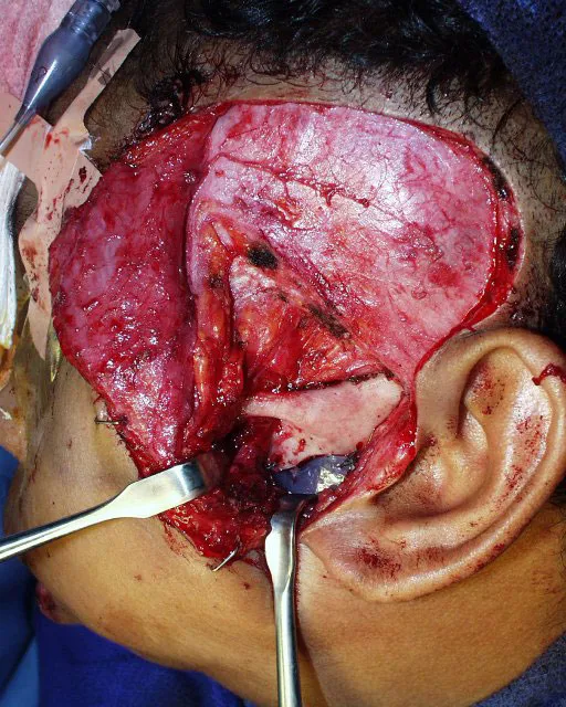 Charitable Surgeries