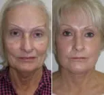 featured makeovers