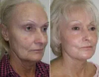 featured makeovers