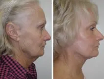 featured makeovers