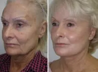 featured makeovers