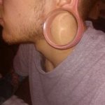 gauged earlobe repair