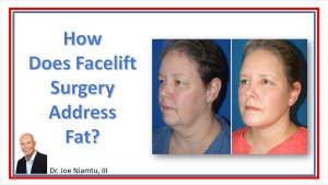 How does facelift surgery address fat?