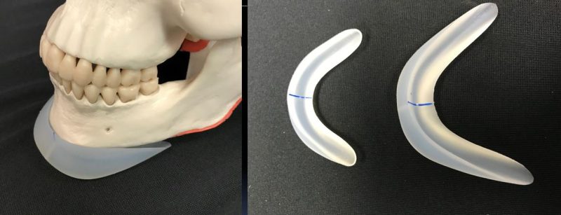 Chin & Lower Facial Implants