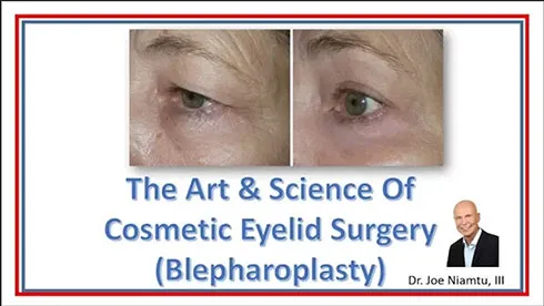 The Art and Science of Cosmetic Eyelid Surgery