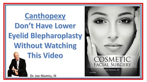 Canthopexy: Don't Do Lower Eyelid Blepharoplasty Without Watching This Video