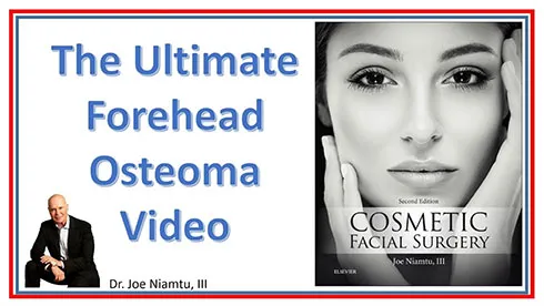 The ultimate forehead osteoma video