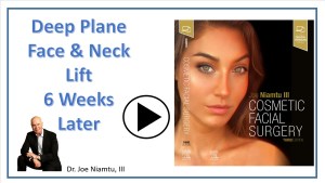 Facelift video