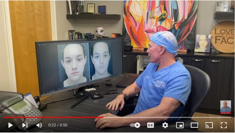 otoplasty protruding ears