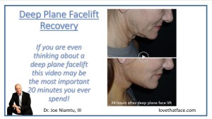 Facelift video