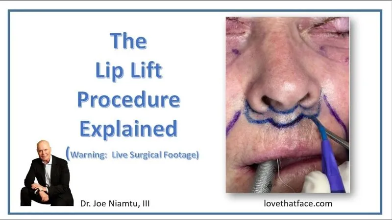 Lip Lift Procedure Explained