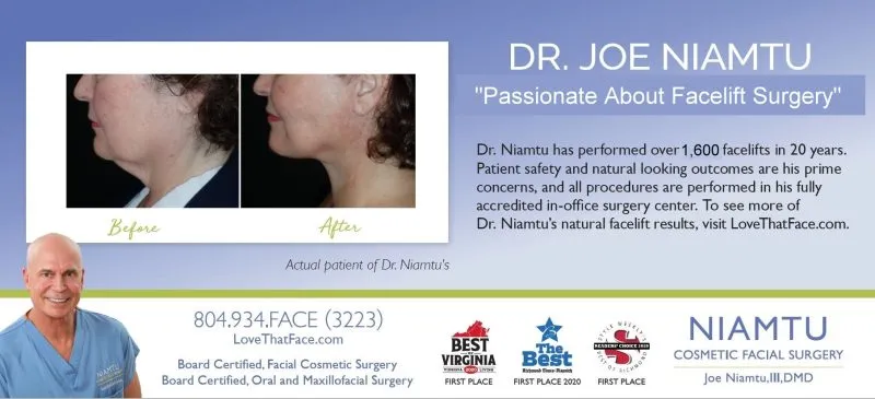 facelift article