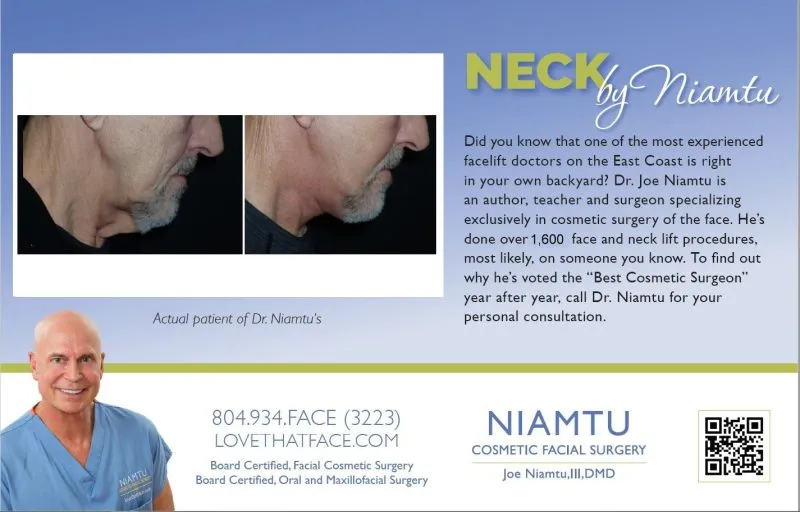 facelift