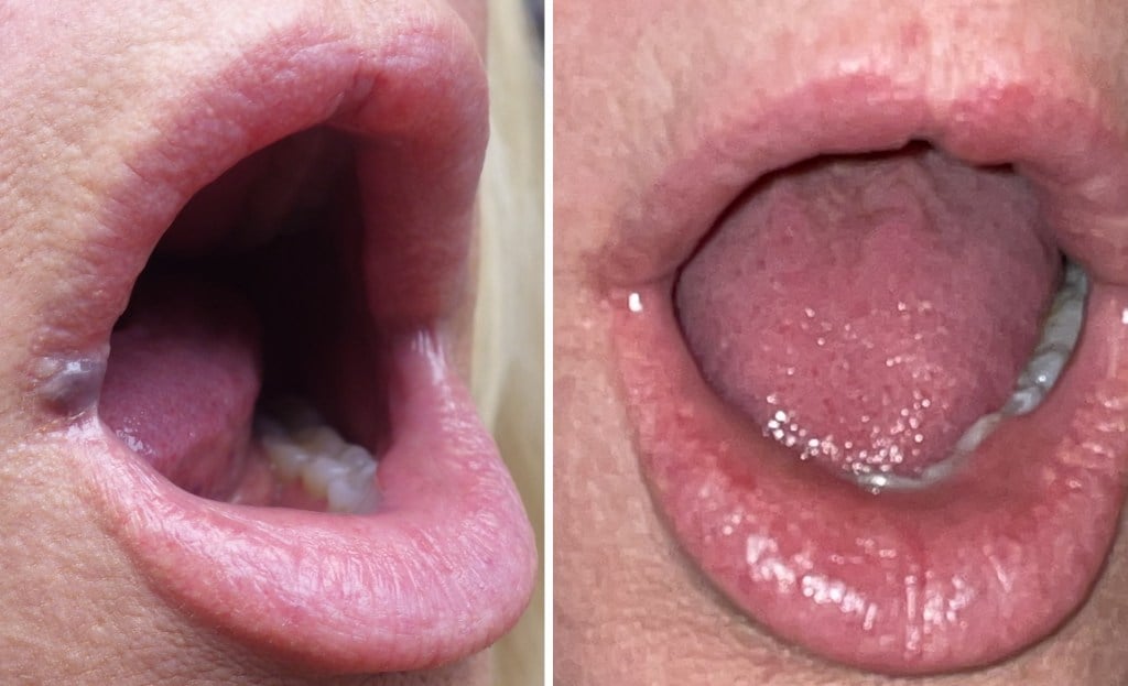 up close image of an open mouth