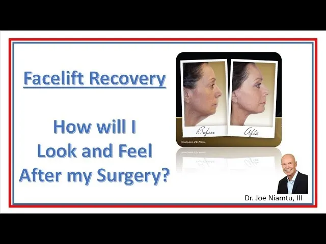 Facelift Recovery: How Will I Look And Feel After My Surgery? Video Thumbnail