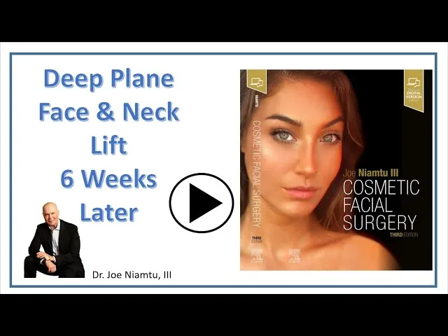 Deep Plane Face & Neck Lift: Six Days Later Video Thumbnail