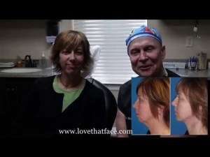 A Happy Facelift Patient Discusses Her Surgical Experience With Dr. Joe Niamtu, III Video Thumbnail