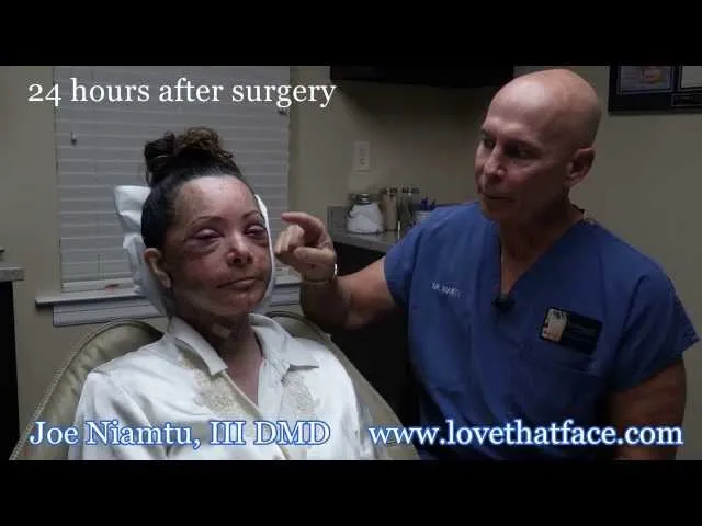 The Truth About Facelift Recovery With Multiple Procedures: By Dr. Joe Niamtu, III Video Thumbnail