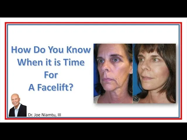 How Do You Know When It Is Time For A Facelift? Video Thumbnail
