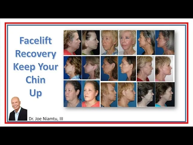 Facelift Recovery: Keep Your Chin Up! Video Thumbnail