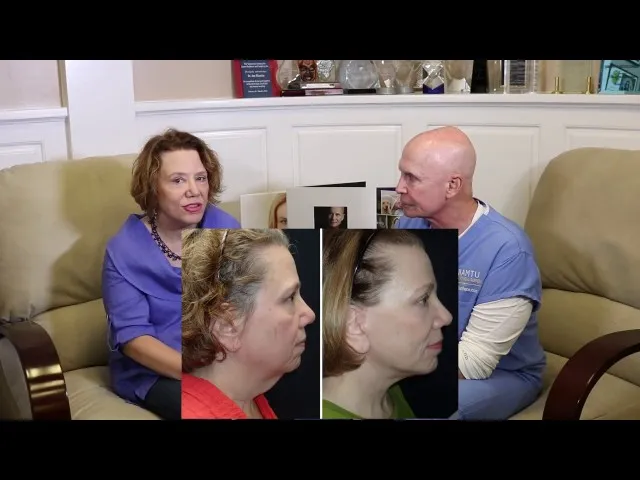 Facelift Surgery Is The Best Decision I Ever Made Video Thumbnail
